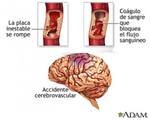 foto de ficha